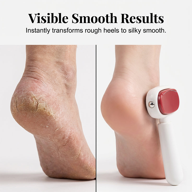 2-in-1 Foot Callus Remover – Dual-Sided Foot Scraper with Replaceable Stainless Steel Blades